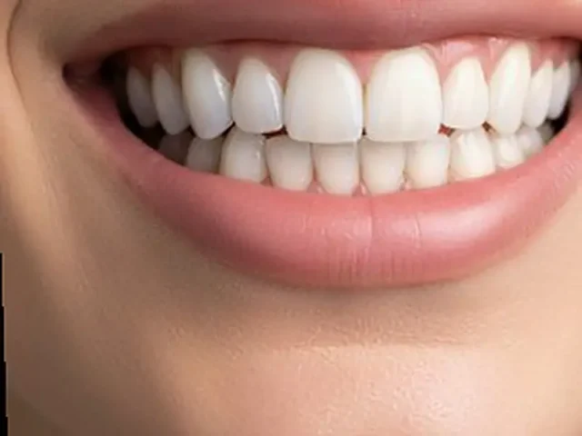 אחרי ציפויי שיניים, זווית נוספת – סמייל סטודיו